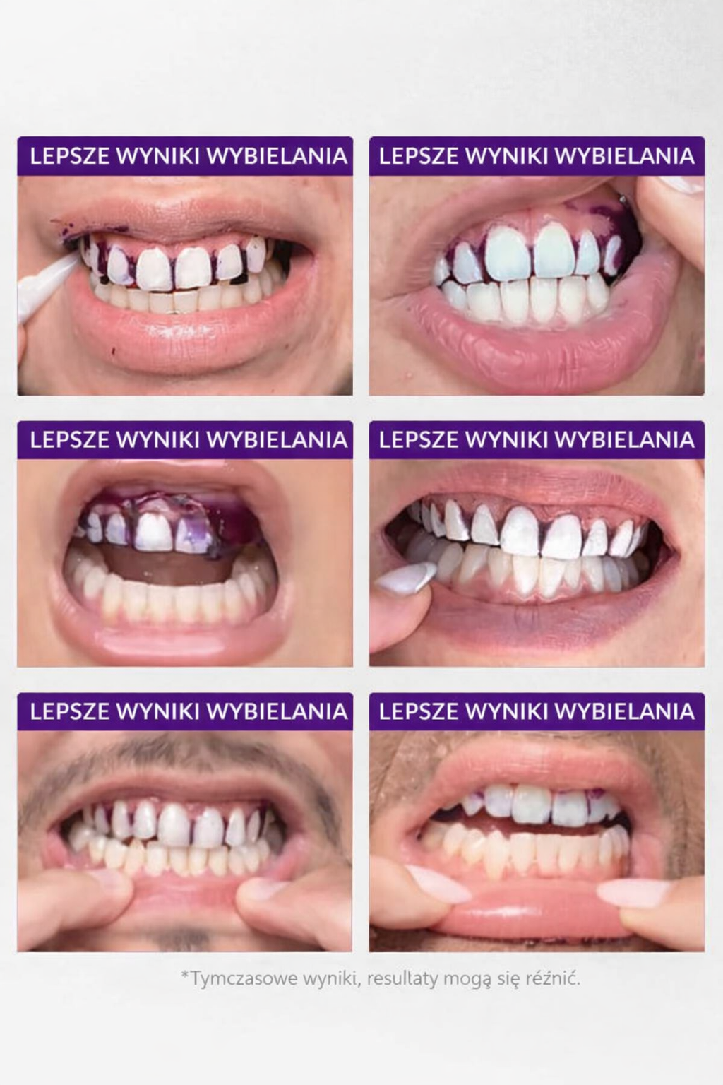 Paski do wybielania zębów