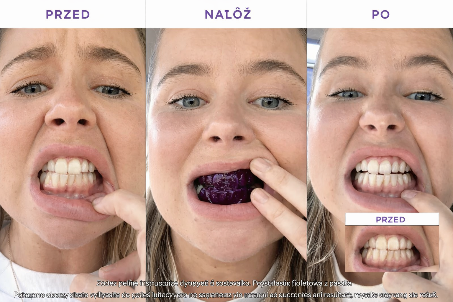 Paski do wybielania zębów